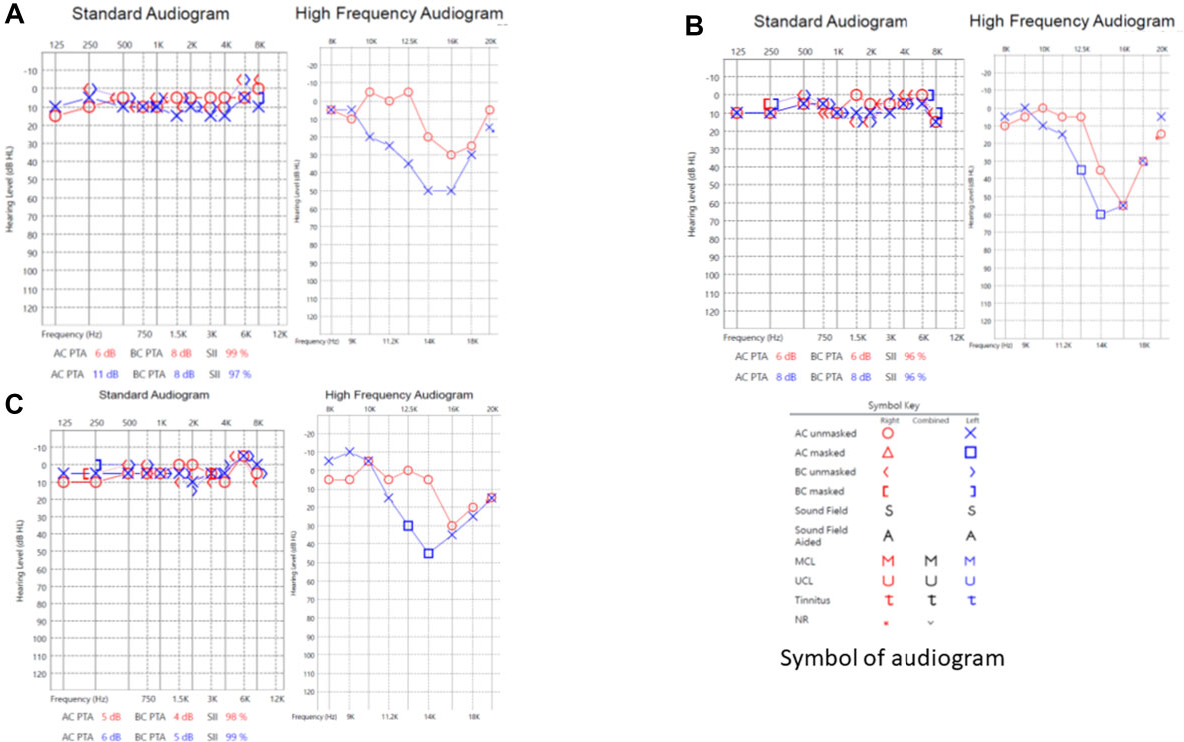 Overwhelming need to investigate covid 19 vaccine tinnitus researchers