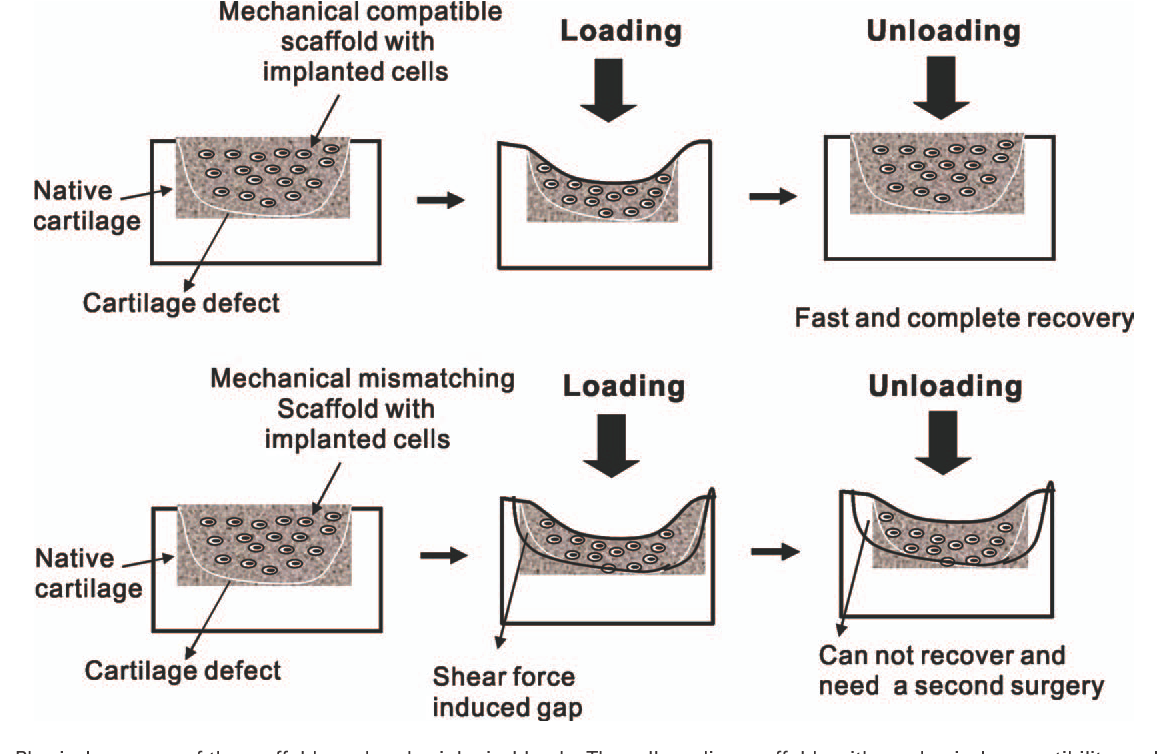 New material can regrow damaged cartilage in joints