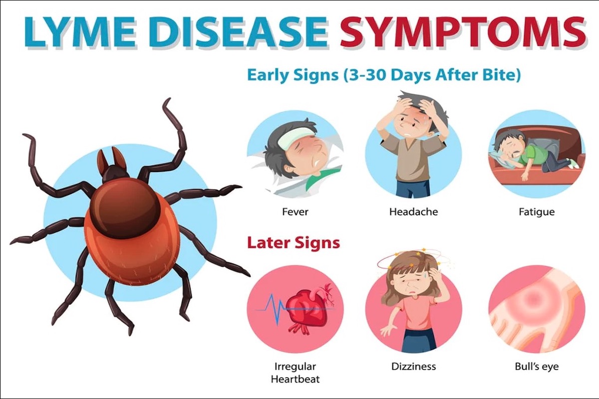 Lyme symptoms rash stages infectiousness cre8 nerve homecuresthatwork arthritis appropriate antibiotics cdc contrast rapidly recover usually fatigue cellcore