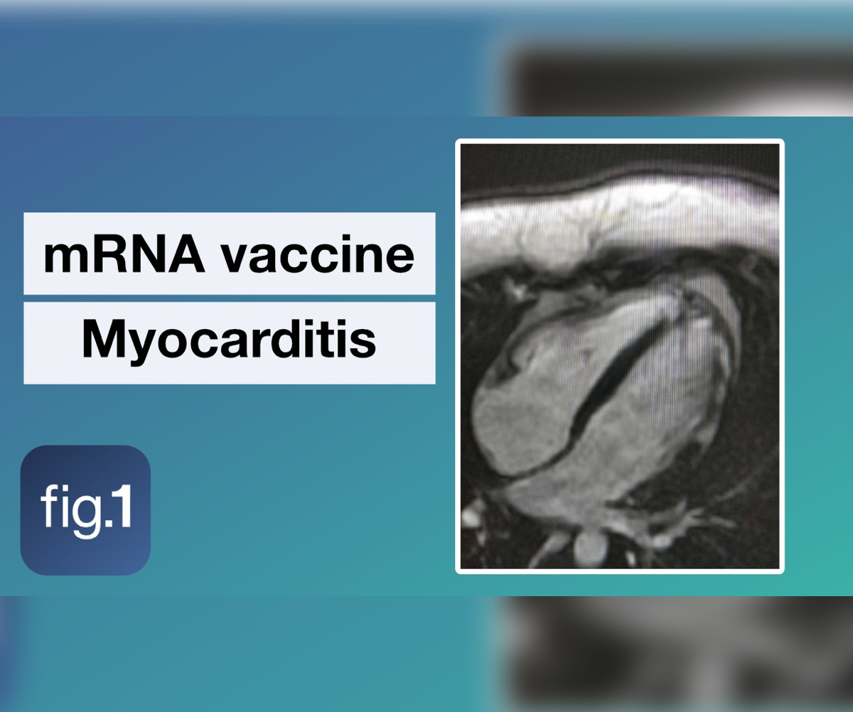 Us military study on postvaccination myocarditis released