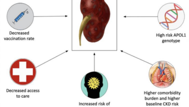 Twenty eight types of kidney complications reported following covid 19 vaccination