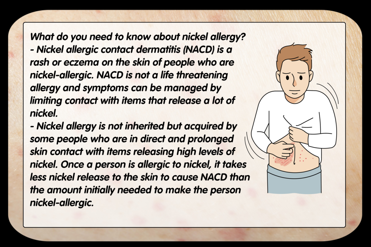 Nickel allergy a common denominator for many with gastrointestinal diseases