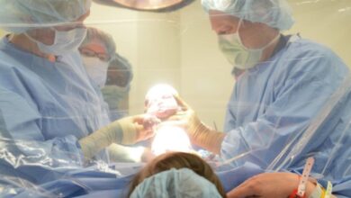 C section births higher risks for mothers higher profits for hospitals