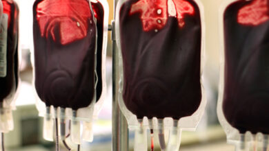 Researchers concerned about blood transfusions from vaccinated and long covid patients propose changes