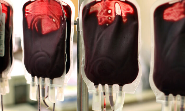 Researchers concerned about blood transfusions from vaccinated and long covid patients propose changes