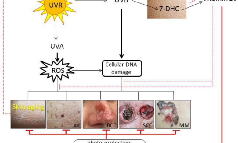 Vitamin d reduces risk of melanoma and other skin cancer study