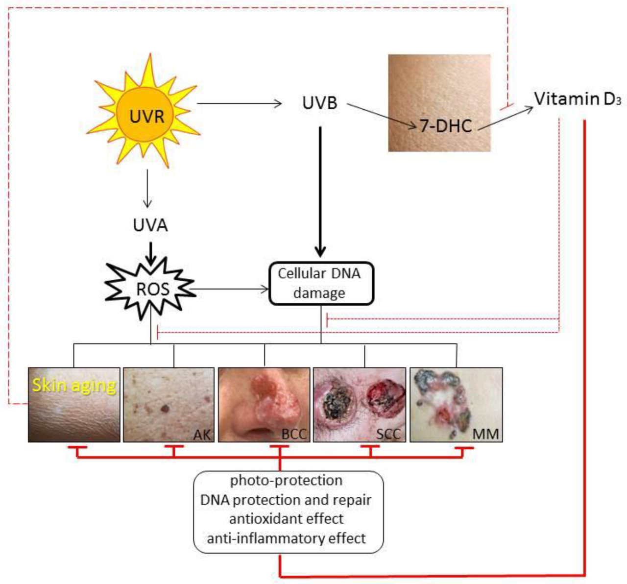 Vitamin d reduces risk of melanoma and other skin cancer study