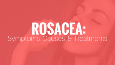 Rosacea symptoms causes treatments and natural approaches