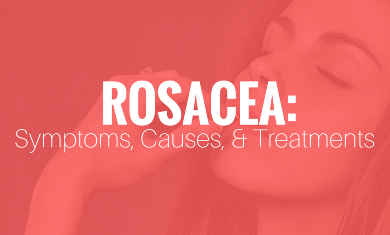 Rosacea symptoms causes treatments and natural approaches