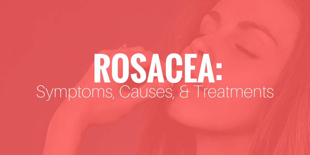 Rosacea symptoms causes treatments and natural approaches