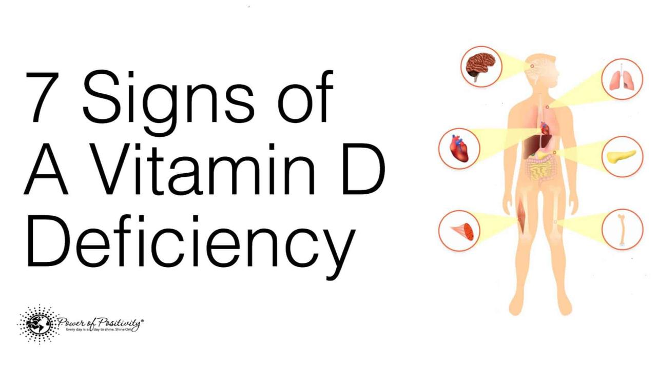 Low vitamin d levels linked to slower healing in childrens fractures