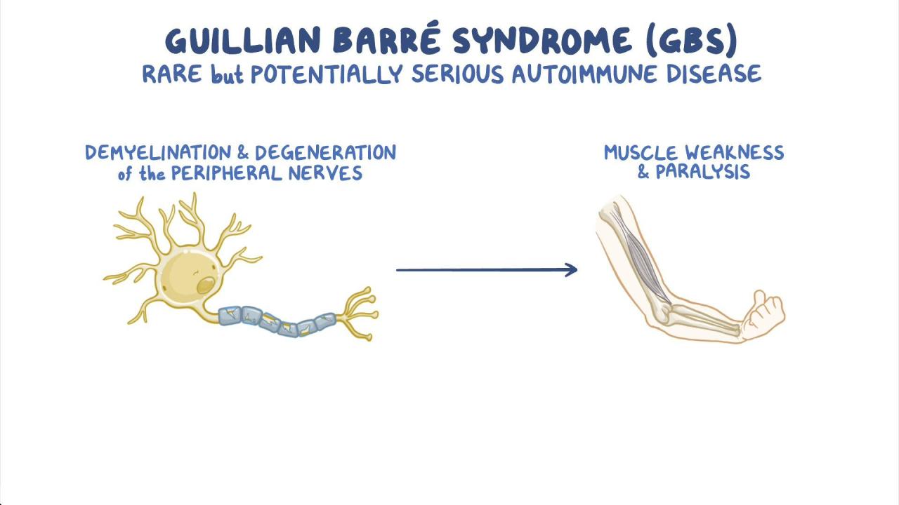 Syndrome guillain barré rapidly progress pdf columbiamissourian