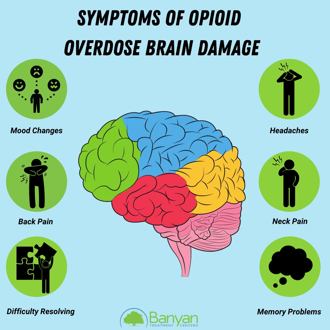 Addiction opioids opioid heroin philly reshape suffer mental illness scientists ian haydon thinking dysregulation